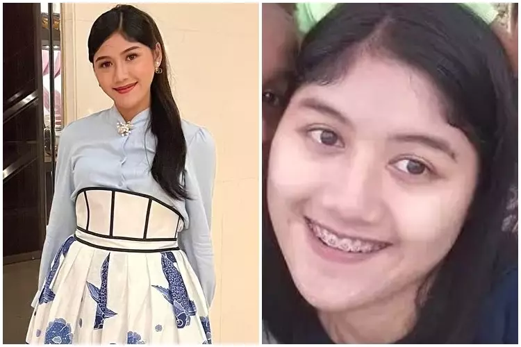 7 Potret Erina Gudono saat pakai dan tanpa makeup Berbagai sumber 7 Potret Erina Gudono saat pakai dan tanpa makeup Berbagai sumber