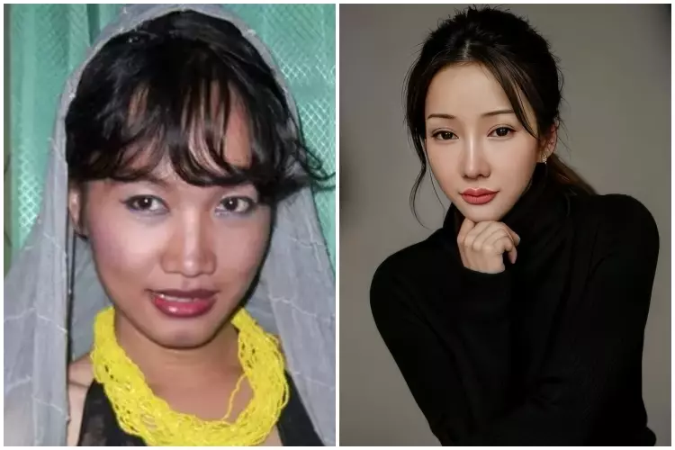 7 Potret before after selebgram usai oplas ini manglingi Berbagai sumber