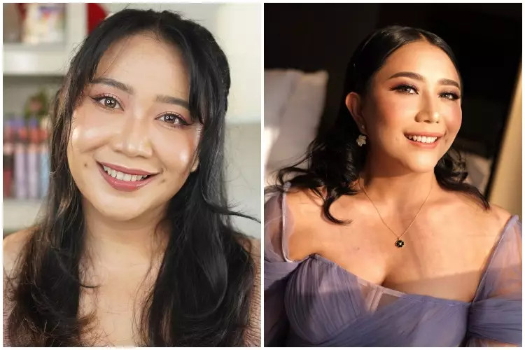 7 Potret before after selebgram usai oplas ini manglingi Berbagai sumber