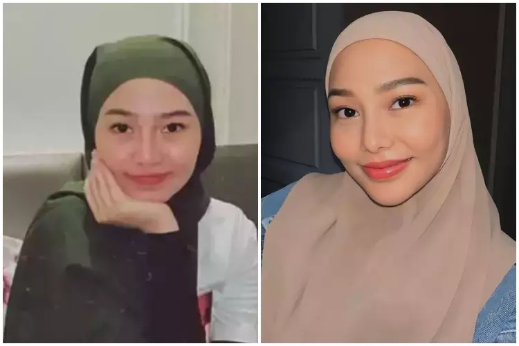 7 Potret before after selebgram usai oplas ini manglingi Berbagai sumber