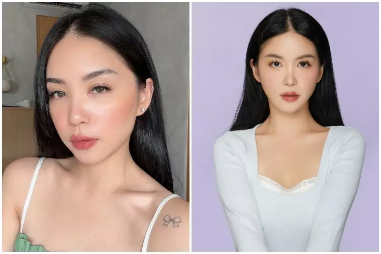 7 Potret before after selebgram usai oplas ini manglingi Berbagai sumber