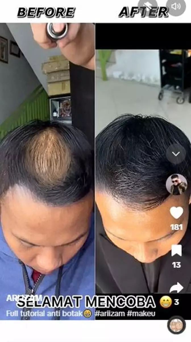 Trik styling rambut cowok botak depan dan tengah cuma perlu 4 langkah TikTok Trik styling rambut cowok botak depan dan tengah cuma perlu 4 langkah TikTok