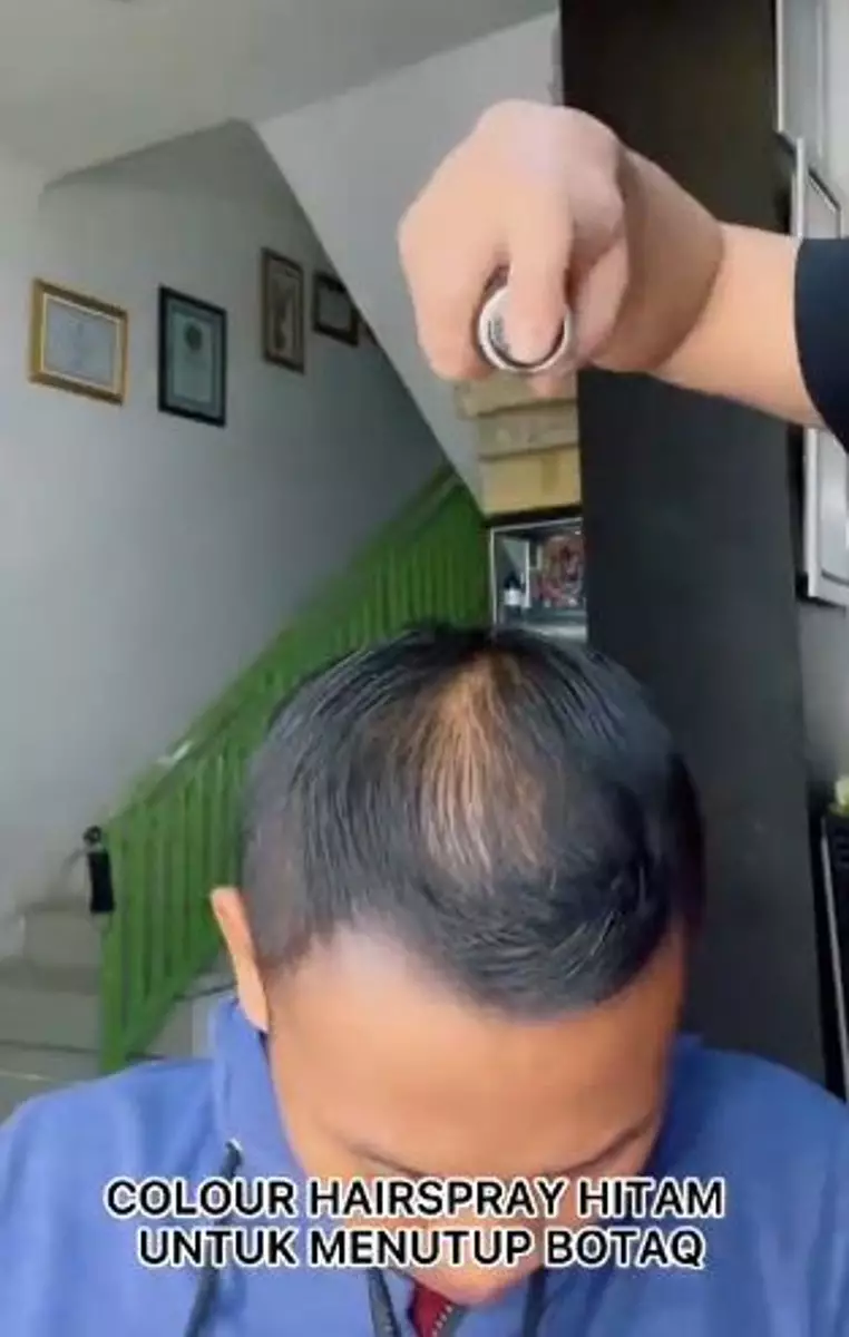 Trik styling rambut cowok botak depan dan tengah cuma perlu 4 langkah TikTok Trik styling rambut cowok botak depan dan tengah cuma perlu 4 langkah TikTok