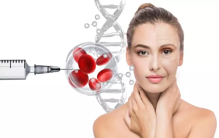 stem cell facelift berbagai sumber