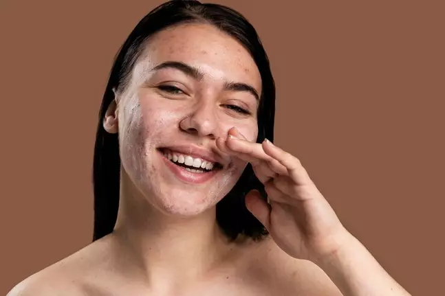 Pakai acne patch sebelum atau sesudah skincare © 2024 freepik.com