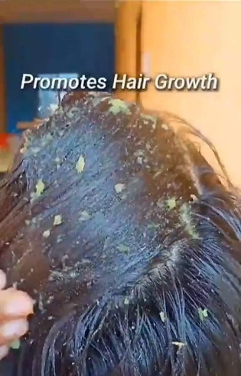 Kombinasi bawang merah dan 1 jenis daun bisa mengurangi kerontokan rambut Berbagai sumber