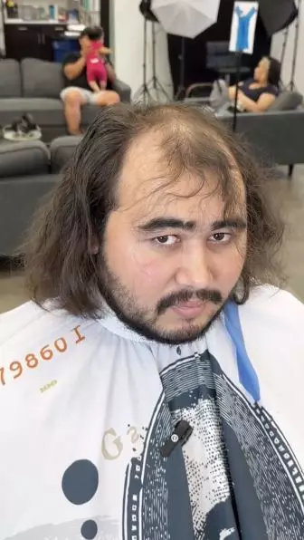 Transformasi pria rambut botak usai di-styling bikin melongo Instagram