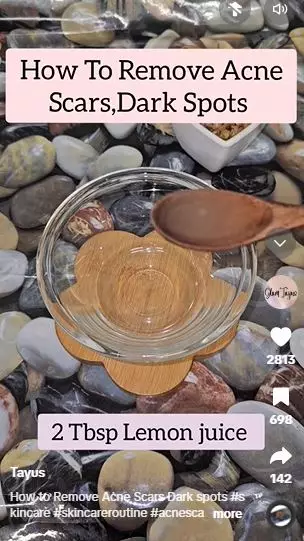 Kombinasi madu dan 1 jenis buah bisa pudarkan bekas jerawat kehitaman Berbagai sumber Kombinasi madu dan 1 jenis buah bisa pudarkan bekas jerawat kehitaman Berbagai sumber