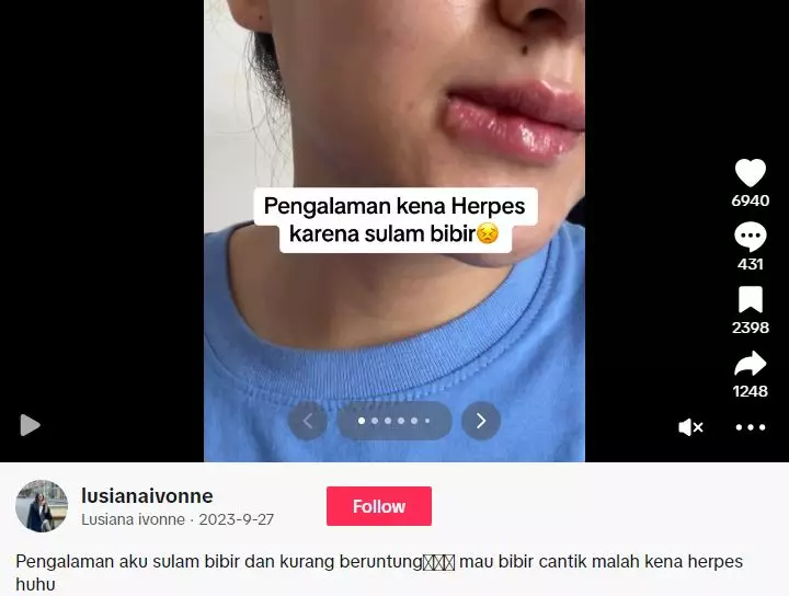 Kisah cewek usai sulam bibir ini berujung idap penyakit seumur hidup TikTok
