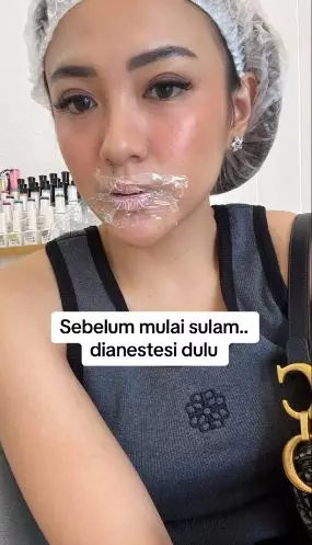 Kisah cewek usai sulam bibir ini berujung idap penyakit seumur hidup TikTok