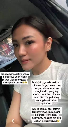 Kisah cewek usai sulam bibir ini berujung idap penyakit seumur hidup TikTok