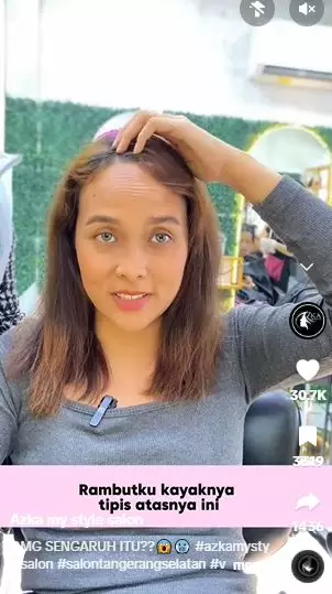 Transformasi cewek rambut botak depan & jenong usai di-styling bak beda orang TikTok Transformasi cewek rambut botak depan & jenong usai di-styling bak beda orang TikTok