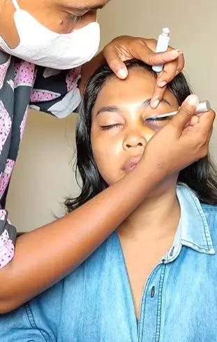 Transformasi wanita dengan lebam di wajah ini hasilnya auto mulus TikTok