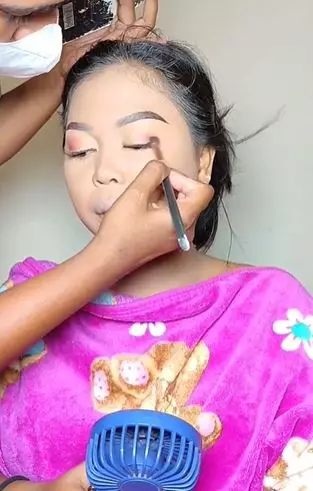 Transformasi wanita dengan lebam di wajah ini hasilnya auto mulus TikTok