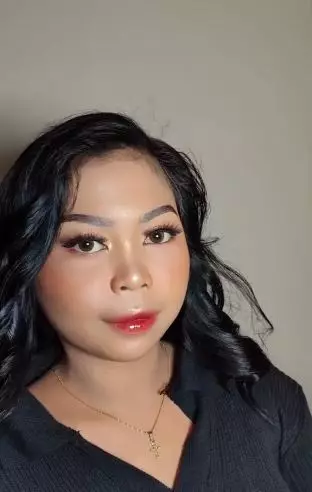 Transformasi wanita dengan lebam di wajah ini hasilnya auto mulus TikTok