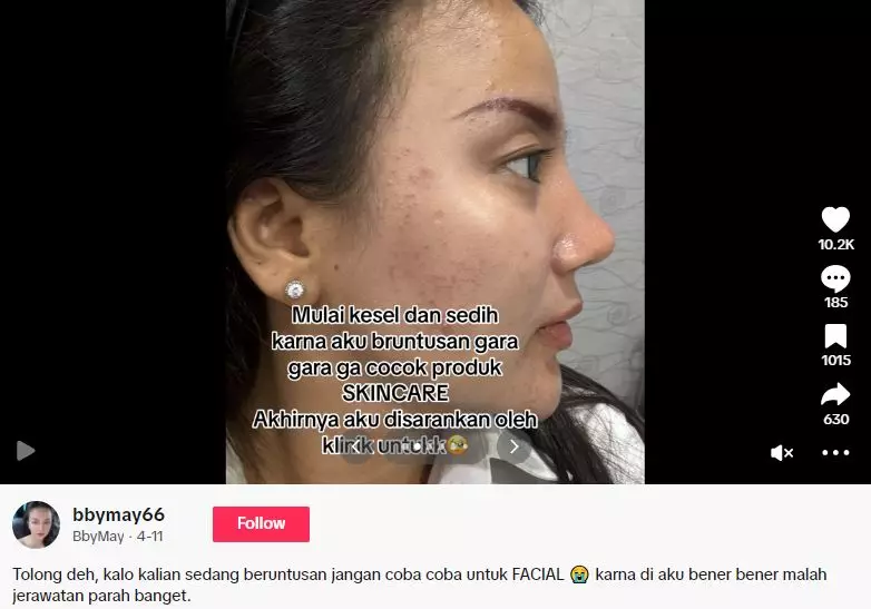 Wajah cewek beruntusan akibat salah skincare malah makin parah usai treatment TikTok Wajah cewek beruntusan akibat salah skincare malah makin parah usai treatment TikTok