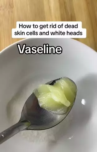 Petroleum jelly dan 1 bahan pemanis bisa atasi komedo putih Berbagai sumber