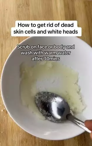 Petroleum jelly dan 1 bahan pemanis bisa atasi komedo putih Berbagai sumber