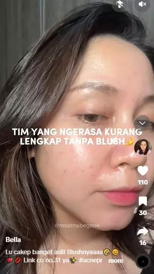 Review Sea Makeup Liquid Blush yang diklaim aman untuk acne prone skin TikTok