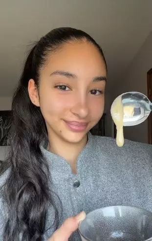 Kombinasi madu dan bahan dapur bisa atasi beruntusan di dahi Berbagai sumber