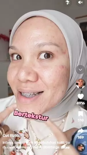 Battle review cushion Tir Tir dan Skintific di wajah acne prone dan oily skin TikTok