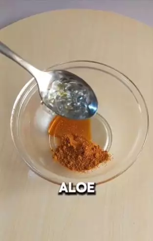 Campuran aloe vera gel dan 2 bahan dapur bisa pudarkan flek hitam Berbagai sumber