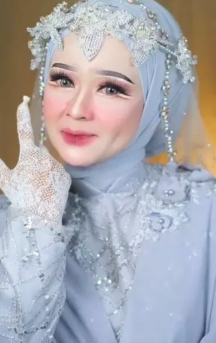 Transformasi wanita wajah penuh flek hitam dirias pengantin bak beda orang TikTok