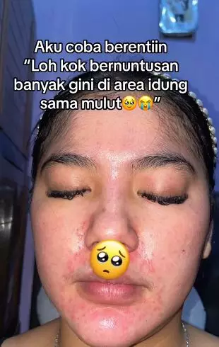 Kisah wanita lepas dari krim dokter wajah tipis berurat jadi sehat kembali TikTok Kisah wanita lepas dari krim dokter wajah tipis berurat jadi sehat kembali TikTok