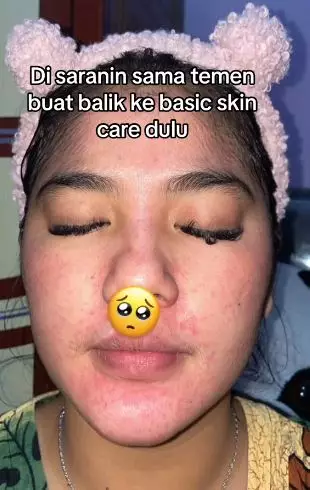 Kisah wanita lepas dari krim dokter wajah tipis berurat jadi sehat kembali TikTok Kisah wanita lepas dari krim dokter wajah tipis berurat jadi sehat kembali TikTok