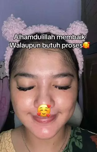 Kisah wanita lepas dari krim dokter wajah tipis berurat jadi sehat kembali TikTok Kisah wanita lepas dari krim dokter wajah tipis berurat jadi sehat kembali TikTok