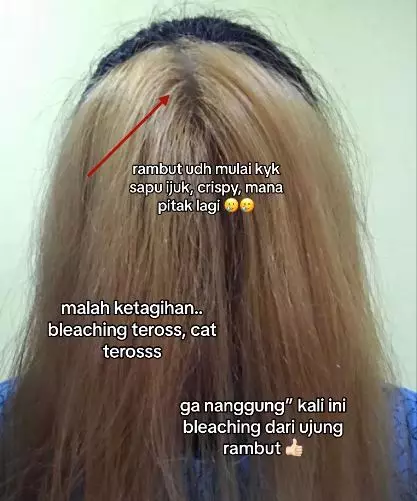 Cewek ini bagikan perjuangan sembuhkan rambut rusak efek bleaching TikTok Cewek ini bagikan perjuangan sembuhkan rambut rusak efek bleaching TikTok