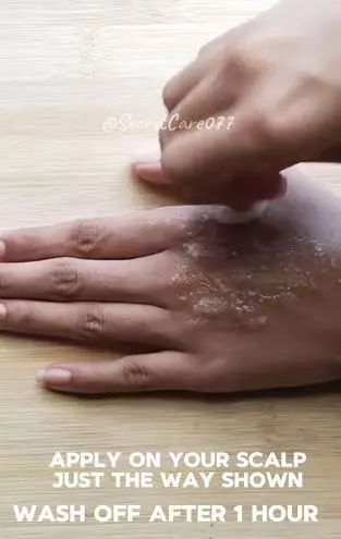 Baking soda dicampur 2 bahan dapur bisa atasi ketombe membandel Berbagai sumber