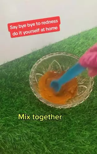 Aloe vera gel dicampur 1 jenis rempah dapur efektif atasi kemerahan di wajah Berbagai sumber Aloe vera gel dicampur 1 jenis rempah dapur efektif atasi kemerahan di wajah Berbagai sumber