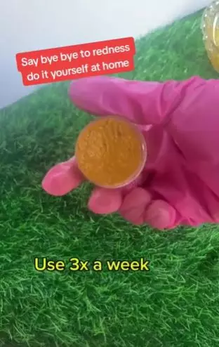 Aloe vera gel dicampur 1 jenis rempah dapur efektif atasi kemerahan di wajah Berbagai sumber Aloe vera gel dicampur 1 jenis rempah dapur efektif atasi kemerahan di wajah Berbagai sumber