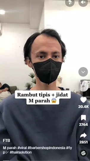Pria rambut tipis dan botak M usai di styling bak pakai fake hair TikTok
