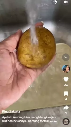 1 Jenis umbi-umbian bisa sembuhkan jerawat dan pudarkan bekasnya Berbagai sumber