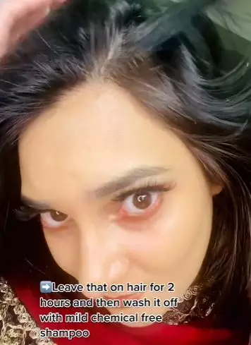 Coconut oil dicampur 1 jenis buah bisa atasi ketombe dalam sekali pakai Berbagai sumber