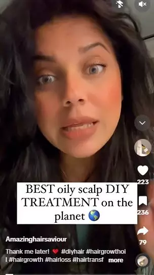 Daun rosemary dicampur 1 jenis buah bisa atasi rambut lepek dan berminyak Berbagai sumber Daun rosemary dicampur 1 jenis buah bisa atasi rambut lepek dan berminyak Berbagai sumber