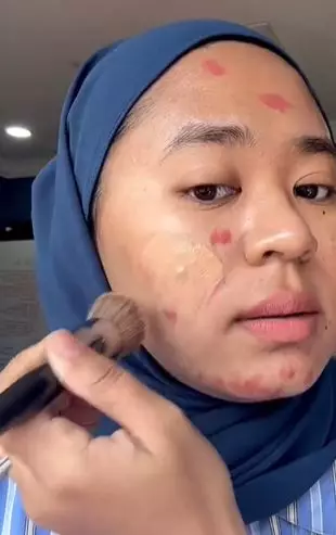 Trik tutupi jaringan parut jerawat justru pakai produk tak terduga TikTok
