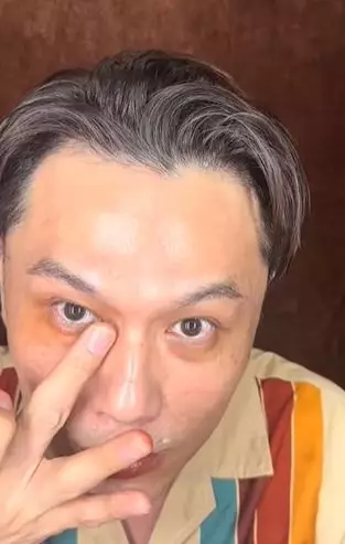 Trik tutupi mata panda tanpa bikin crack cuma andalkan 1 produk tak terduga TikTok