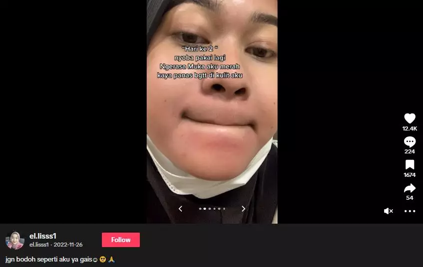 Kisah cewek pakai krim racikan dokter malah berujung menyesal TikTok