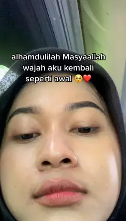 Kisah cewek pakai krim racikan dokter malah berujung menyesal TikTok