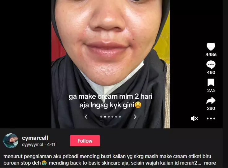 Akibat nggak rutin pakai krim etiket biru berujung kemerahan hampir seluruh wajah TikTok Akibat nggak rutin pakai krim etiket biru berujung kemerahan hampir seluruh wajah TikTok