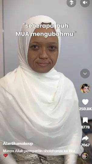 Transformasi cewek kulit gelap dan smile line tebal dirias jadi pengantin TikTok Transformasi cewek kulit gelap dan smile line tebal dirias jadi pengantin TikTok