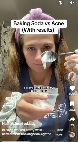 Bahan pembuat kue ternyata efektif bikin jerawat meradang cepat kering Berbagai sumber