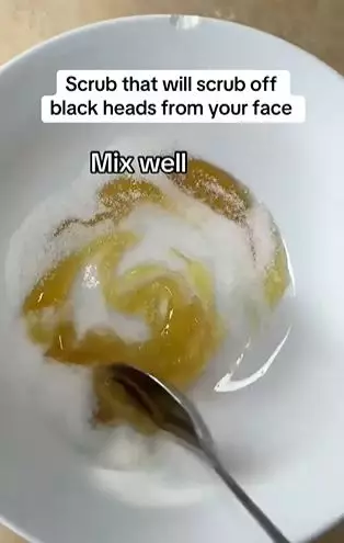Campuran 2 bahan dapur bisa atasi komedo di wajah secara efektif Berbagai sumber