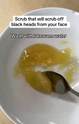 Campuran 2 bahan dapur bisa atasi komedo di wajah secara efektif Berbagai sumber