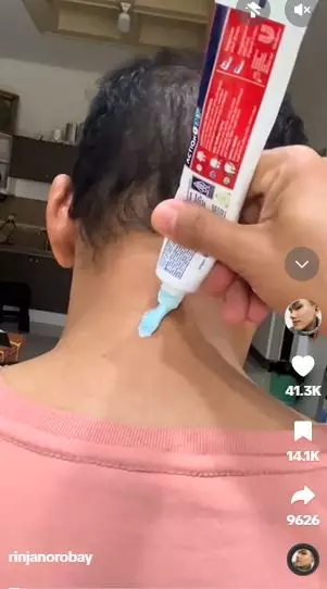 Pasta gigi dicampur 2 bahan dapur bisa atasi leher hitam dan belang Berbagai sumber Pasta gigi dicampur 2 bahan dapur bisa atasi leher hitam dan belang Berbagai sumber