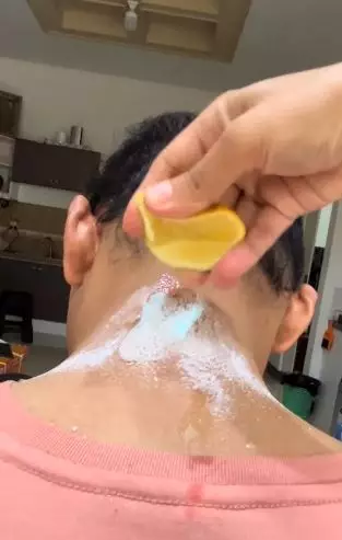 Pasta gigi dicampur 2 bahan dapur bisa atasi leher hitam dan belang Berbagai sumber Pasta gigi dicampur 2 bahan dapur bisa atasi leher hitam dan belang Berbagai sumber