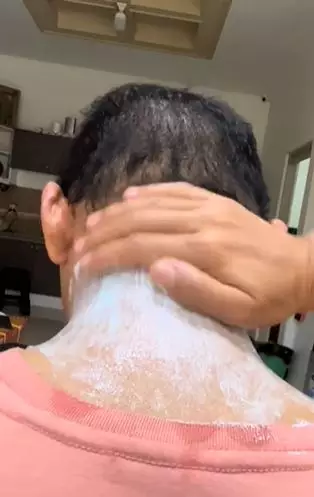 Pasta gigi dicampur 2 bahan dapur bisa atasi leher hitam dan belang Berbagai sumber Pasta gigi dicampur 2 bahan dapur bisa atasi leher hitam dan belang Berbagai sumber